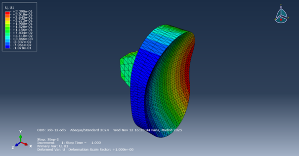 Glenoid implant study card preview
